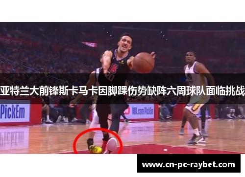 亚特兰大前锋斯卡马卡因脚踝伤势缺阵六周球队面临挑战 亚特兰大前锋斯卡马卡因脚踝伤势缺阵六周球队面临挑战